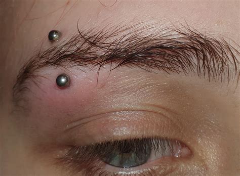 eyebrow piercing rejection